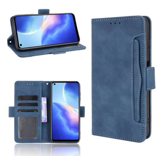 For Blackview A90 Skin Feel Calf Pattern Horizontal Flip Leather Case with Holder & Card Slots & Photo Frame(Blue) - More Brand by buy2fix | Online Shopping UK | buy2fix